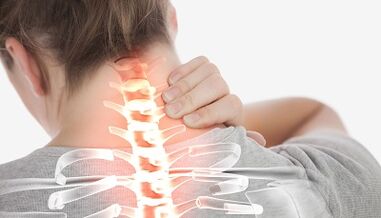 Servikal omurganın osteokondrozu nasıl tedavi edilir