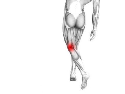 Diz ekleminin osteoartriti