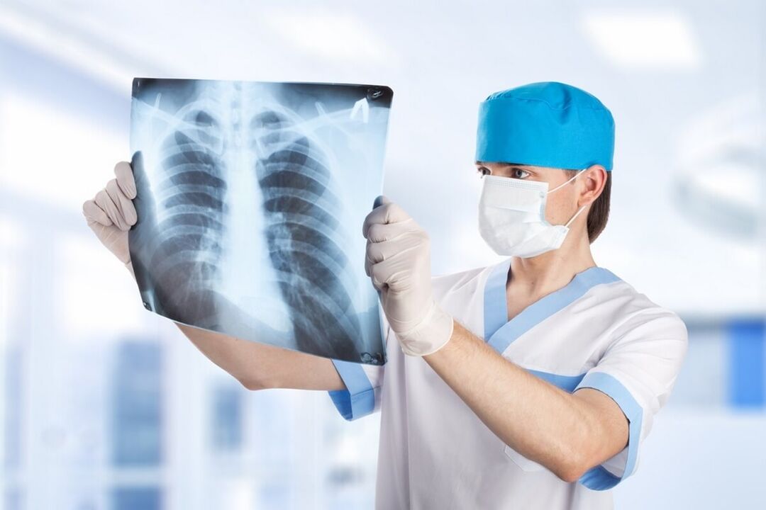 Osteokondrozlu göğüs röntgeni