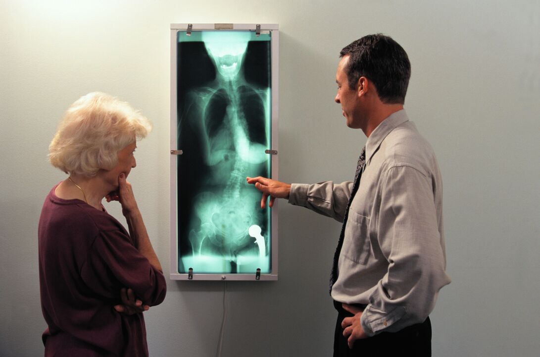 Kalça ekleminde ağrı için röntgen teşhisi